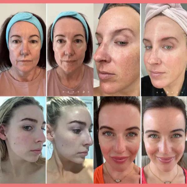 CollagenGlow® - Máscara Facial de Colágeno + BRINDE LIMITADO